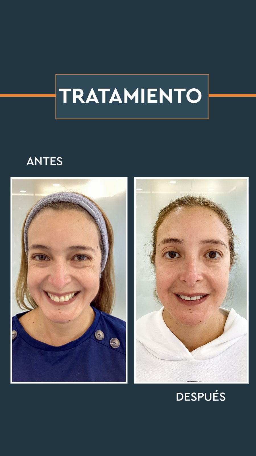 Acido hialuronico en bogotá