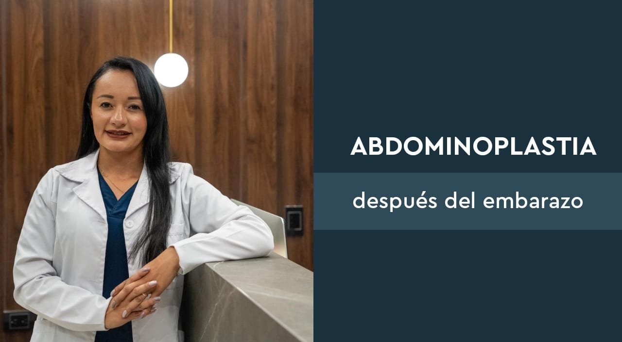 ABDOMINOPLASTIA DESPUÉS DEL EMBARAZO