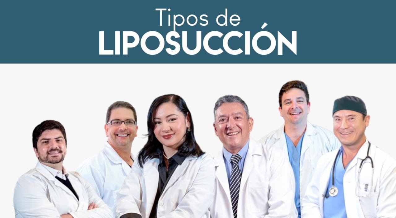 Tipos de Liposucción