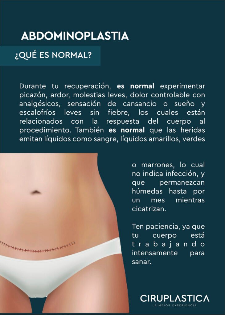 POSTOPERATORIO ABDOMINOPLASTIA 18 ABDO Que es normal