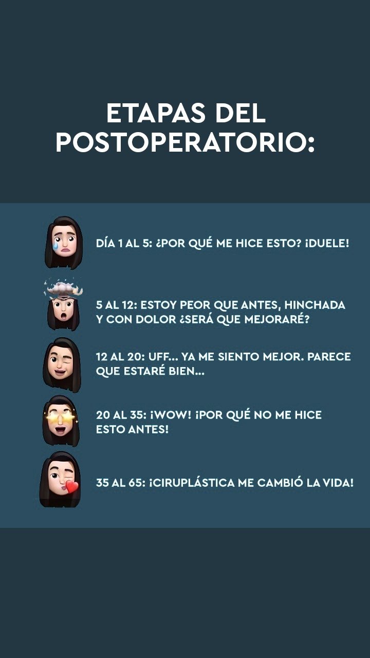 ETAPAS