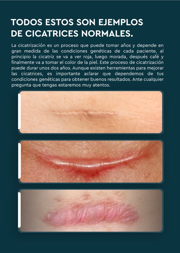 Ejemplos de cicatrices 1