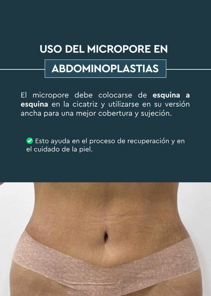 POSTOPERATORIO ABDOMINOPLASTIA 37 Micropore en abdominoplastia