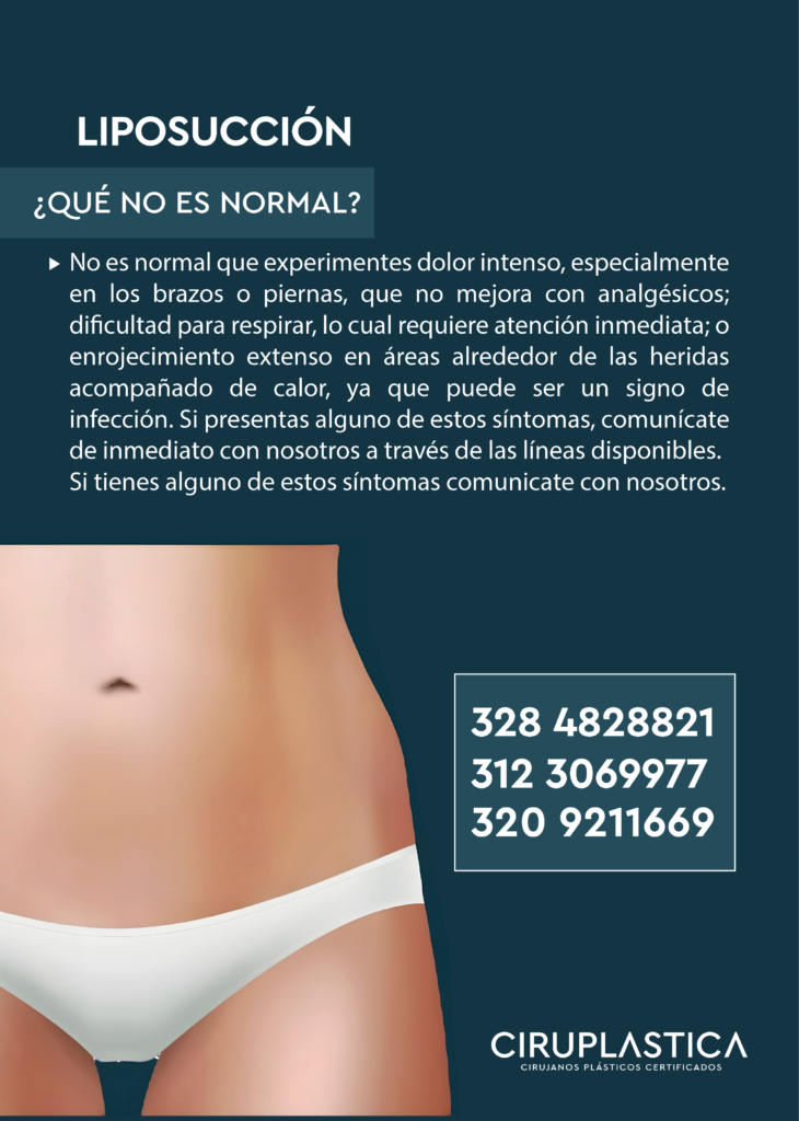 POSTOPERATORIO LIPOSUCCIÓN 36 lipo que no es normal 1