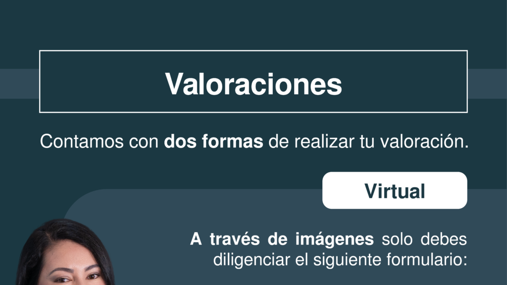 por partes valoraciones